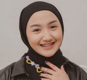 Wujudkan Senyum Impian dengan Behel dan Whitening di Casadienta Dental Clinic